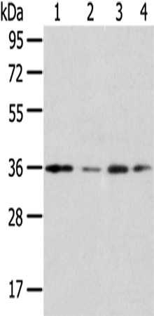 Anti-HOXD13 Rabbit Polyclonal Antibody