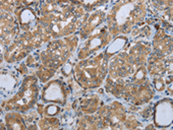 Anti-PPP1R13L Rabbit Polyclonal Antibody