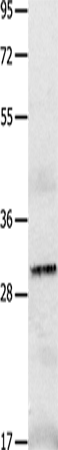 Anti-IL-2 Receptor alpha Rabbit Polyclonal Antibody