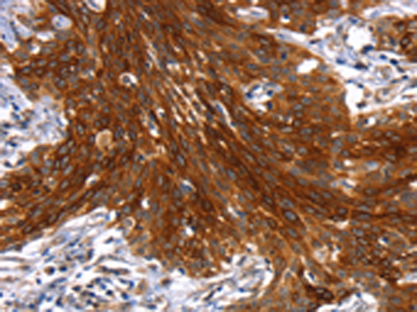 Anti-JNK2 Rabbit Polyclonal Antibody