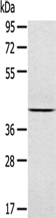 Anti-JNK2 Rabbit Polyclonal Antibody