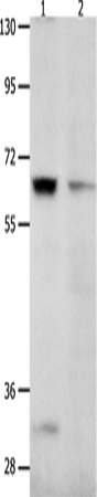 Anti-KCNC2 Rabbit Polyclonal Antibody