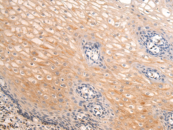 Anti-LAYN Rabbit Polyclonal Antibody