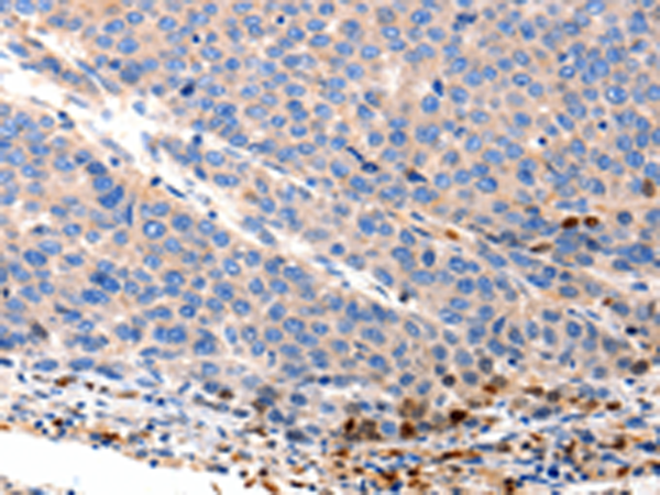Anti-OLR1 Rabbit Polyclonal Antibody