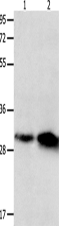 Anti-OLR1 Rabbit Polyclonal Antibody