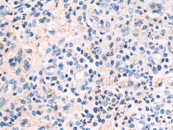 Anti-Luteinizing Hormone beta Rabbit Polyclonal Antibody