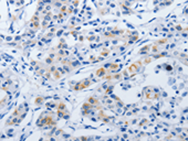 Anti-BPIFB3 Rabbit Polyclonal Antibody