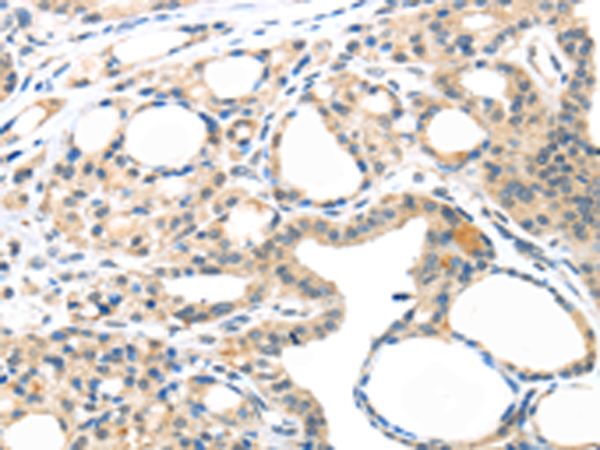 Anti-MASP2 Rabbit Polyclonal Antibody