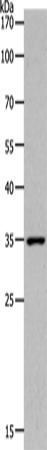 Anti-MC2R Rabbit Polyclonal Antibody