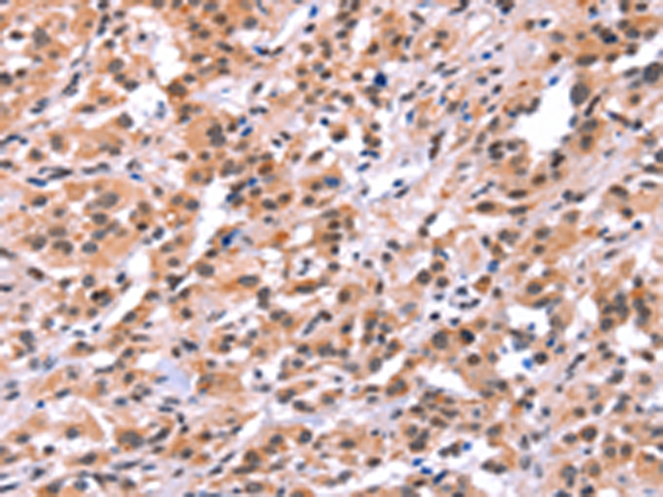 Anti-MYF5 Rabbit Polyclonal Antibody