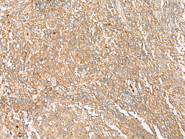 Anti-MMP26 Rabbit Polyclonal Antibody