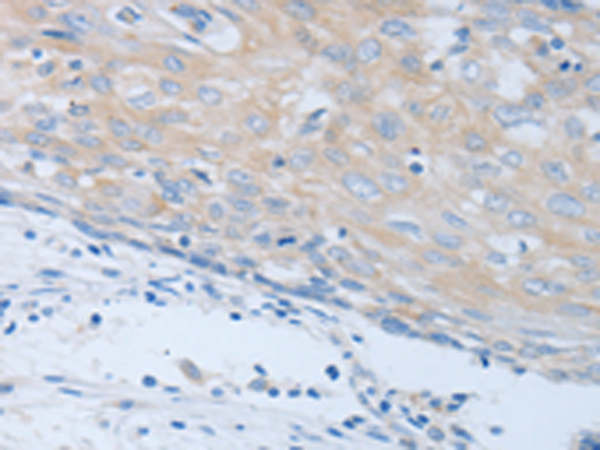 Anti-CHRFAM7A Rabbit Polyclonal Antibody