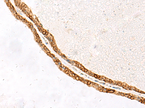 Anti-NFASC Rabbit Polyclonal Antibody