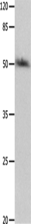 Anti-P2RY2 Rabbit Polyclonal Antibody