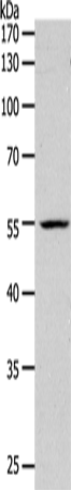 Anti-PAX1 Rabbit Polyclonal Antibody