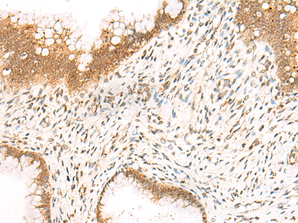 Anti-PAX5 Rabbit Polyclonal Antibody
