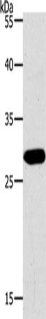 Anti-PAX5 Rabbit Polyclonal Antibody