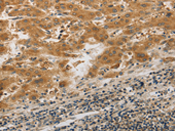 Anti-PIBF1 Rabbit Polyclonal Antibody