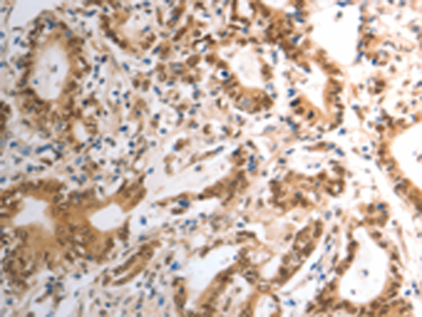 Anti-Rad50 Rabbit Polyclonal Antibody