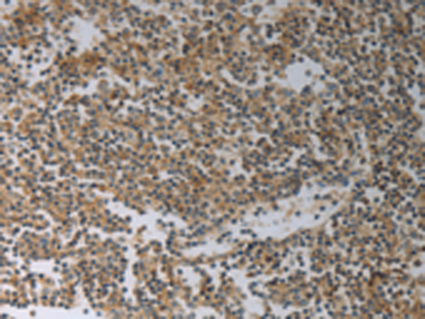 Anti-SLC4A7 Rabbit Polyclonal Antibody
