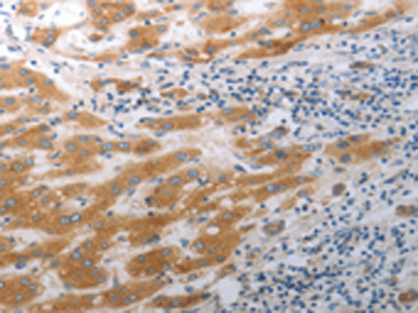 Anti-SLC12A6 Rabbit Polyclonal Antibody