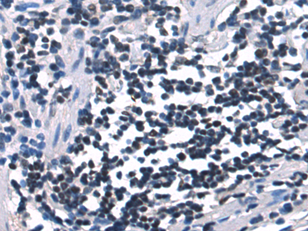 Anti-Smad7 Rabbit Polyclonal Antibody
