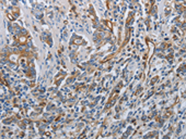 Anti-SOCS1 Rabbit Polyclonal Antibody