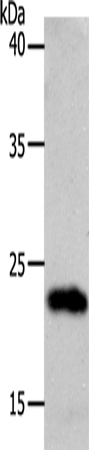 Anti-SOCS1 Rabbit Polyclonal Antibody