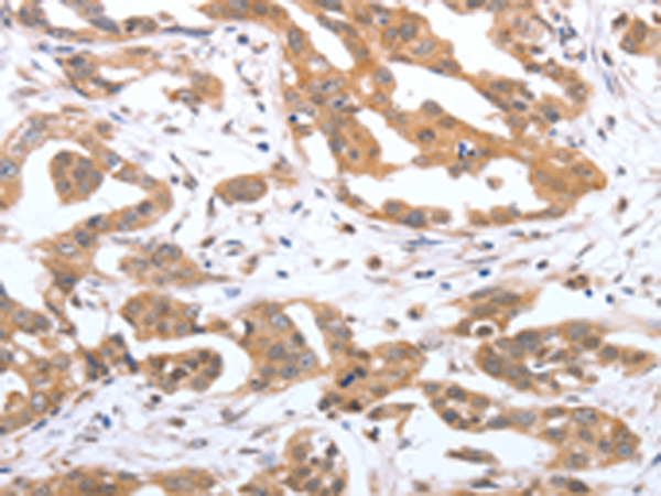 Anti-PSPN Rabbit Polyclonal Antibody