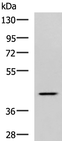 Anti-Synaptotagmin 2 Rabbit Polyclonal Antibody
