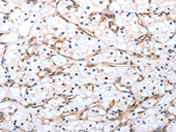 Anti-Selenoprotein S Rabbit Polyclonal Antibody