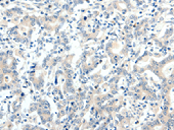 Anti-TRAF7 Rabbit Polyclonal Antibody