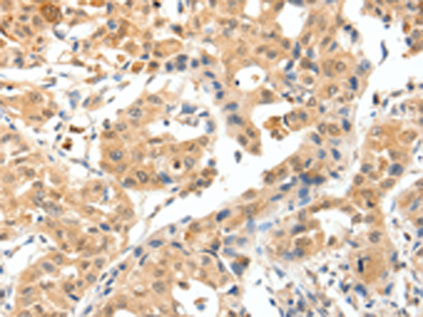 Anti-TPM2 Rabbit Polyclonal Antibody