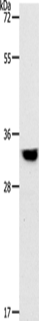 Anti-TPM2 Rabbit Polyclonal Antibody