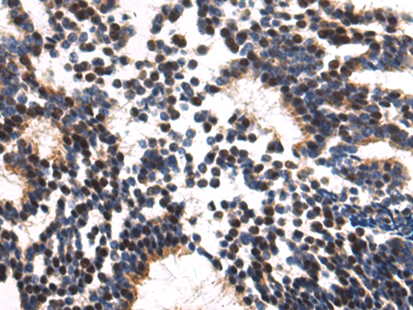 Anti-NFATC4 Rabbit Polyclonal Antibody