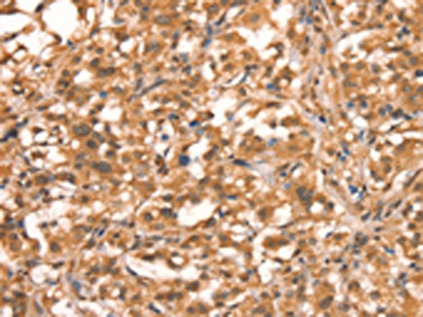 Anti-ACADVL Rabbit Polyclonal Antibody