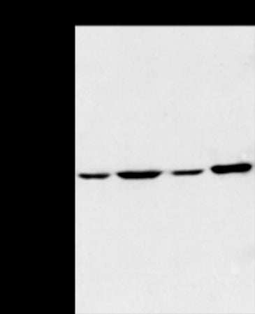 Anti-Adiponectin Receptor 1 Rabbit Polyclonal Antibody