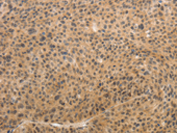 Anti-Adiponectin Receptor 2 Rabbit Polyclonal Antibody