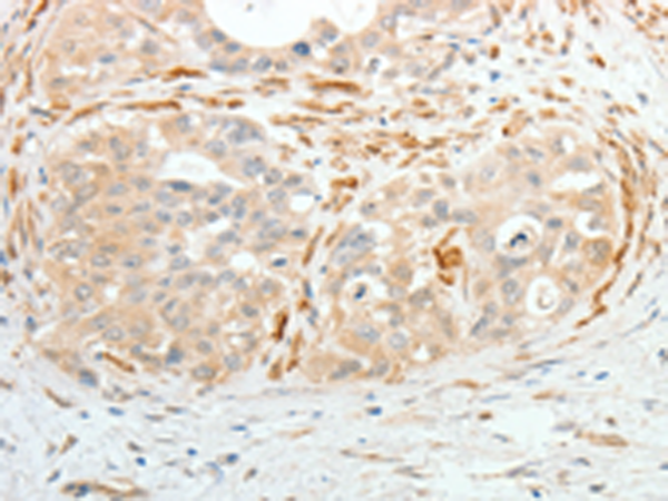 Anti-ADM Rabbit Polyclonal Antibody