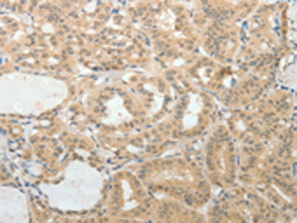 Anti-AFF2 Rabbit Polyclonal Antibody