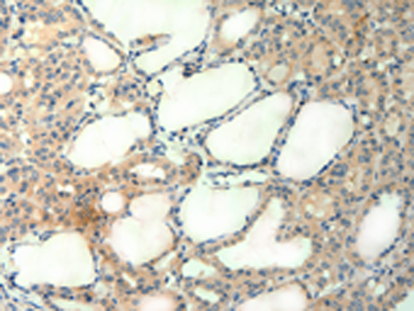 Anti-Agrin Rabbit Polyclonal Antibody