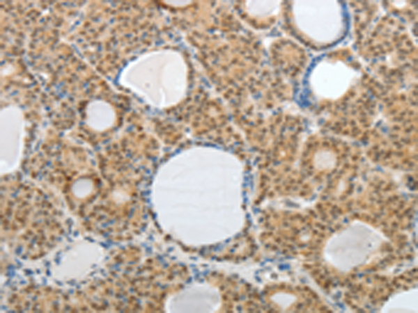 Anti-mAKAP Rabbit Polyclonal Antibody
