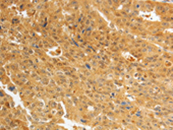 Anti-AKR1A1 Rabbit Polyclonal Antibody