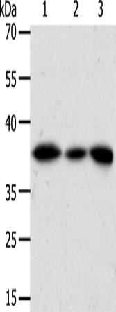 Anti-AKR1A1 Rabbit Polyclonal Antibody