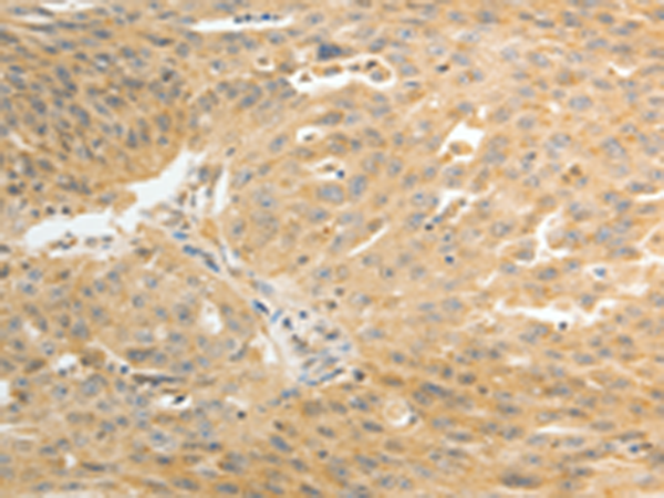Anti-AKR1C1 Rabbit Polyclonal Antibody