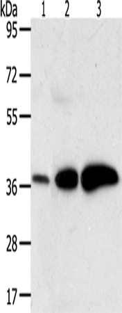 Anti-AKR1C1 Rabbit Polyclonal Antibody