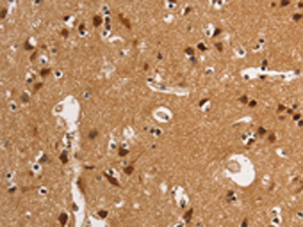 Anti-ANAPC4 Rabbit Polyclonal Antibody