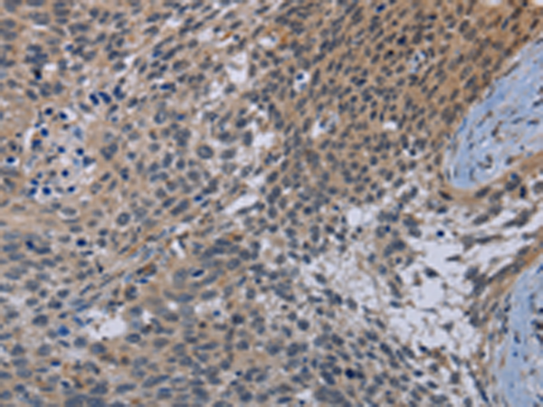 Anti-APC6 Rabbit Polyclonal Antibody
