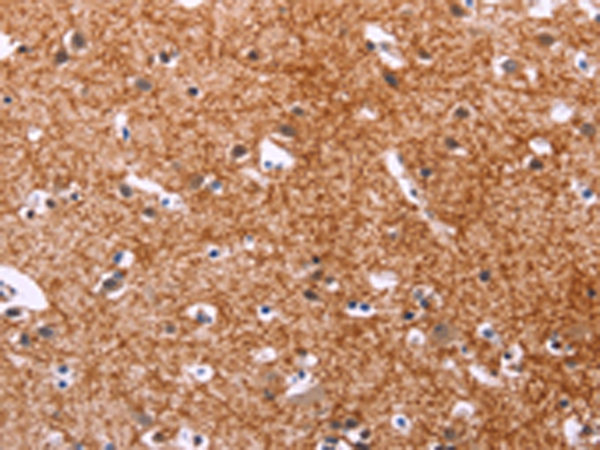 Anti-APMAP Rabbit Polyclonal Antibody