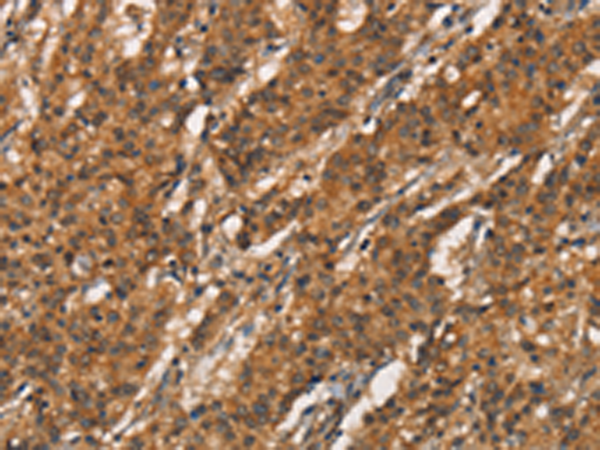 Anti-ApoC4 Rabbit Polyclonal Antibody